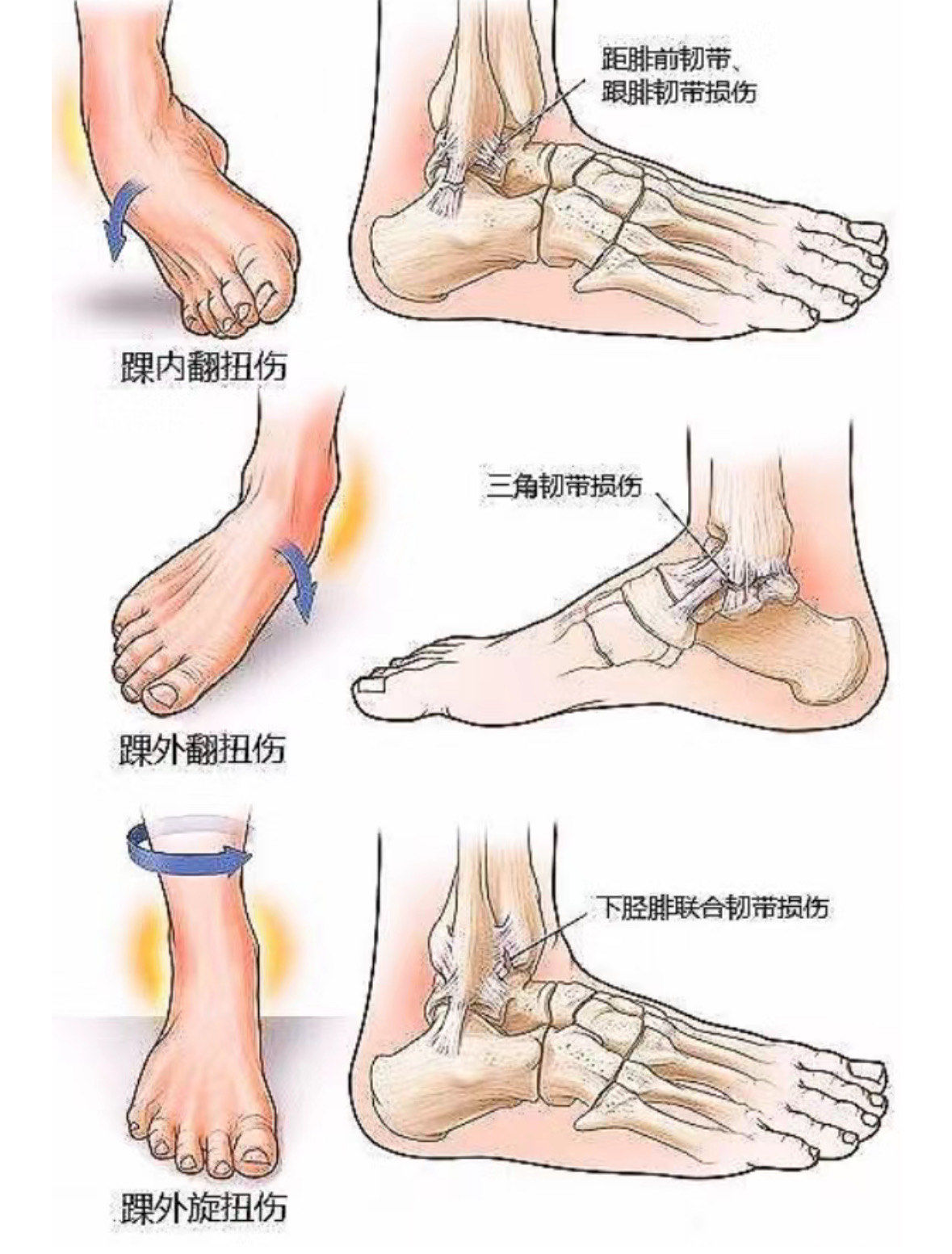 开云APP-云达不莱梅前锋脚踝受伤，愈后康复缓慢