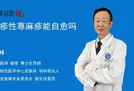 斯萨科现身荨麻疹，巴朗蒂亚失担当